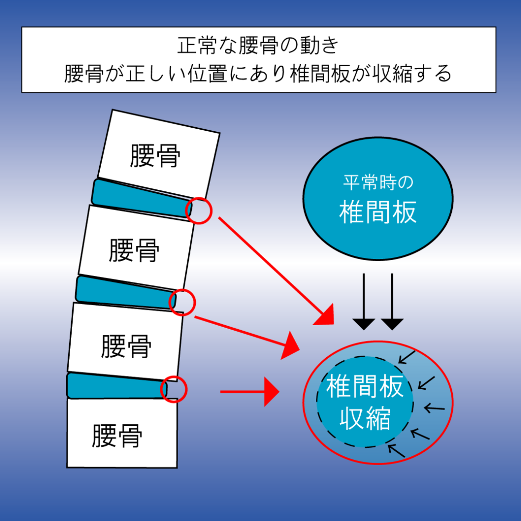 椎間板