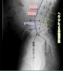 院長レントゲン